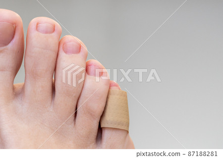 Medical plaster on the female little toe. Wound at toe healed with a band aid for medical care Medical plaster on the female little toe. Wound at toe healed with a band aid for medical care 87188281