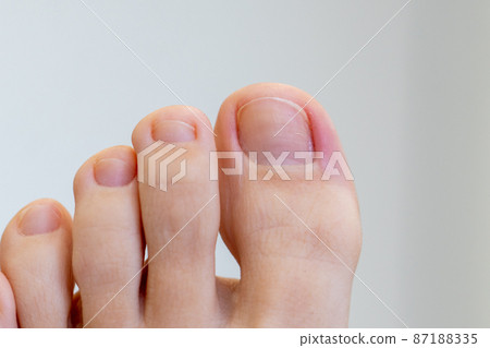 Closeup of female feet and toes. Healthy feet concept Closeup of female feet and toes. Healthy feet concept 87188335