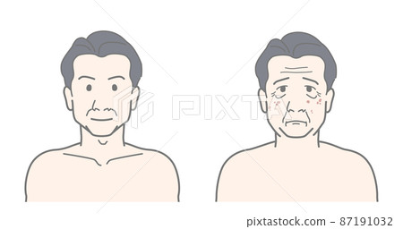 Before After Aging Wrinkles Spots Skin Trouble Men Men's Beauty 87191032