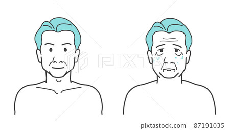 Before After Aging Wrinkles Blemish Skin Trouble Men Men's Beauty 87191035
