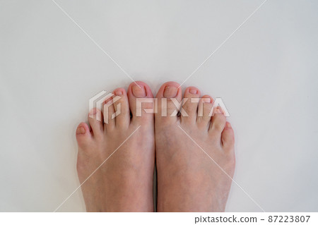 Closeup of female feet and toes on white background. Healthy feet concept Closeup of female feet and toes on white background. Healthy feet concept 87223807