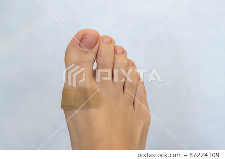 Medical plaster on the female feet. Wound healed with a band aid for medical care Medical plaster on the female feet. Wound healed with a band aid for medical care 87224109