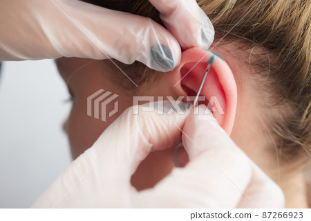 piercings on an ear. Conch and helix piercings close up. piercings on an ear. Conch and helix piercings close up. 87266923
