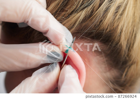 piercings on an ear. Conch and helix piercings close up. piercings on an ear. Conch and helix piercings close up. 87266924