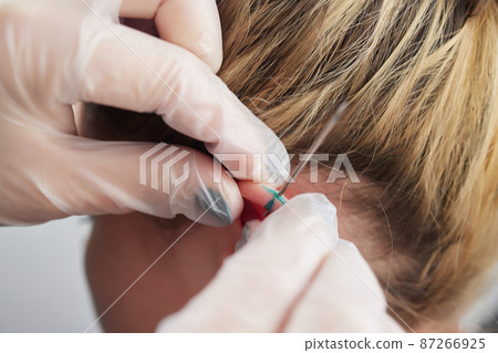 piercings on an ear. Conch and helix piercings close up. piercings on an ear. Conch and helix piercings close up. 87266925