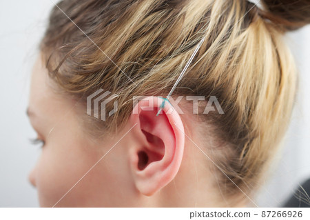 piercings on an ear. Conch and helix piercings close up. piercings on an ear. Conch and helix piercings close up. 87266926