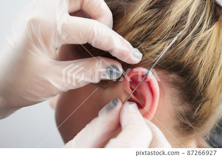 piercings on an ear. Conch and helix piercings close up. piercings on an ear. Conch and helix piercings close up. 87266927