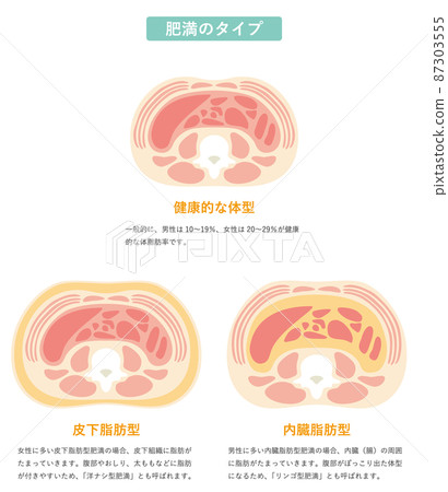Obesity type 02 Obesity type 02 87303555
