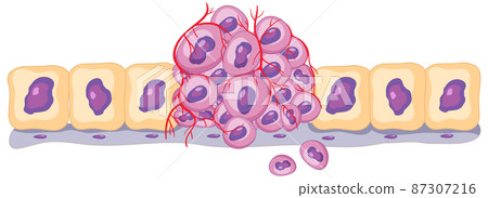 Isolated cancer cell on white background Isolated cancer cell on white background 87307216