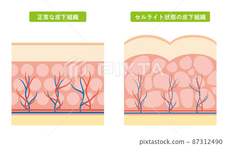 Subcutaneous tissue cross section 01 87312490