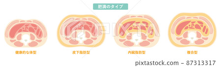 Obesity type 07 87313317