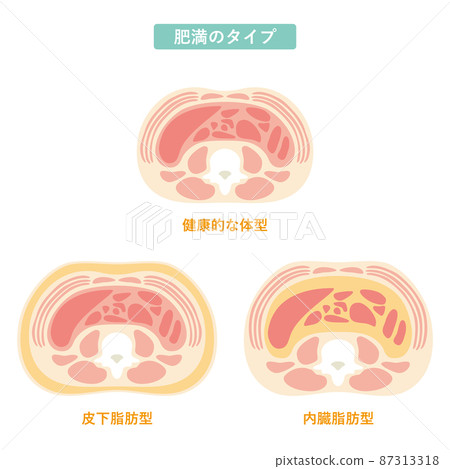 肥胖型 06 87313318