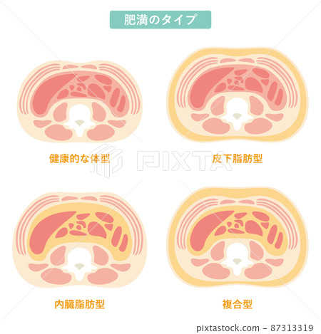 肥胖型 05 87313319