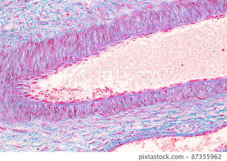 Anatomy and Histological Ovary, Testis and Sperm human cells under microscope. 87355962