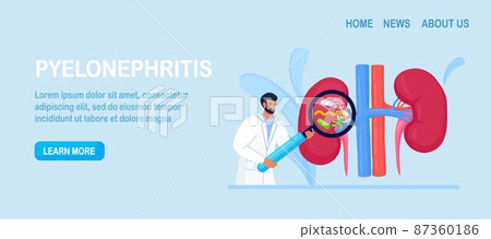 Tiny Doctors Nephrologist Diagnosing Pyelonephritis Disease. Hospital Diagnostic, Treatment of Kidney. Physician with Magnifying Glass. Urology and Nephrology, Nephroptosis, Renal Failure, Cystitis Tiny Doctors Nephrologist Diagnosing Pyelonephritis Disease. Hospital Diagnostic, Treatment of Kidney. Physician with Magnifying Glass. Urology and Nephrology, Nephroptosis, Renal Failure, Cystitis 87360186