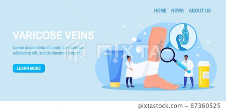 Vein Thrombosis and Varicose Treatment. Tiny surgeons treat vascular diseases, apply tight bandage. Doctor near Big Foot with Diseased Veins. Doppler ultrasonography of the lower extremity arteries 87360525