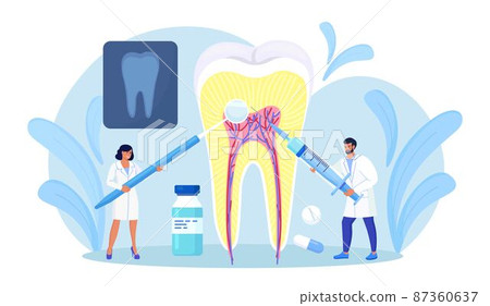 Dentists cleaning and treating big unhealthy tooth with caries cavity. Toothache. Stomatology, Dentistry concept. Doctors with professional instruments for check up and treatment. Dentist appointment Dentists cleaning and treating big unhealthy tooth with caries cavity. Toothache. Stomatology, Dentistry concept. Doctors with professional instruments for check up and treatment. Dentist appointment 87360637