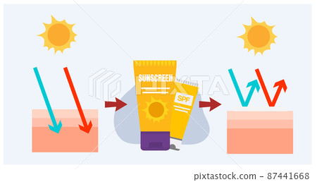 vector infographic of Sun protection,skin care concept,sunscreen, sunblock.before after using sunscreen product on skin layers. 87441668