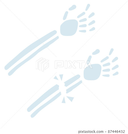 Healthy and sick hand. Broken bone. Element of hospitals and clinics. 87446432