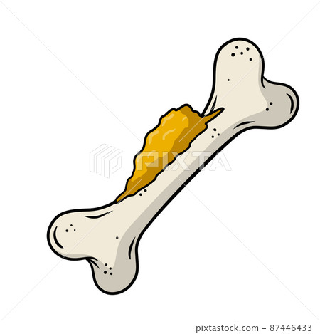 Bone cancer. Disease of the musculoskeletal system. Growth of harmful cells 87446433