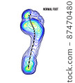 Foot weight distribution. Normal arch foot bottom thermal view. No deformation. 87470480