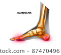 Ball and heel of foot pain bones skeleton realistic anatomy illustration 87470496