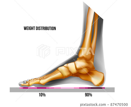 Foot weight distribution. Normal arch foot bones realistic skeleton medial view. Foot weight distribution. Normal arch foot bones realistic skeleton medial view. 87470500