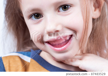 Six-year old caucasian girl shows myofunctional trainer in her mouth Six-year old caucasian girl shows myofunctional trainer in her mouth 87483529