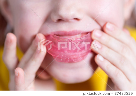 Six-year old caucasian girl shows myofunctional trainer in her mouth Six-year old caucasian girl shows myofunctional trainer in her mouth 87483539