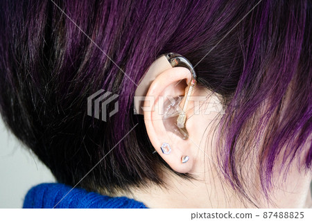 Skin-colored hearing aids 87488825