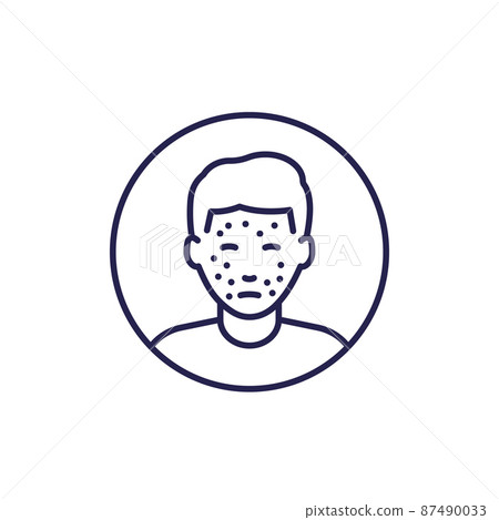 acne icon, skin problem, rash line vector - Stock Illustration ...