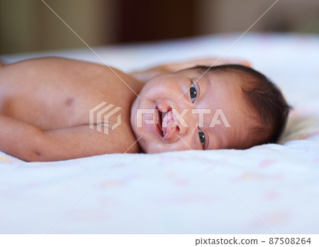 She wont let her birth defect get her down. Portrait of a baby girl with a cleft palate lying on a bed. She wont let her birth defect get her down. Portrait of a baby girl with a cleft palate lying on a bed. 87508264