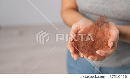 Close-up of a female hand holding with a bun of red hair. Hair loss and female pattern baldness Close-up of a female hand holding with a bun of red hair. Hair loss and female pattern baldness 87510456
