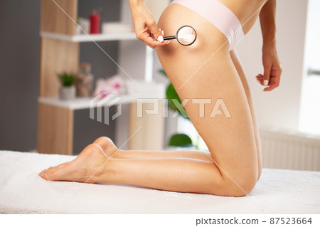 A woman who puts a loupe on her leg. A woman who puts a loupe on her leg. 87523664