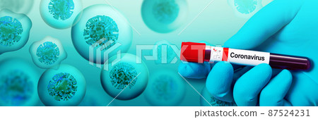 Doctor holding a blood sample with corona virus. 3d illustration 87524231