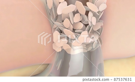 clogged pores, dead skin cells 87537631