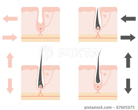 Cross section of how hair grows and illustration set of arrows Cross section of how hair grows and illustration set of arrows 87605075