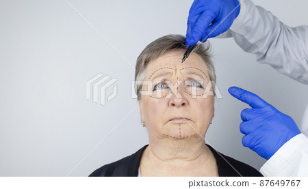 An elderly woman at the reception of a facial plastic surgeon. Consultation on the removal of age wrinkles on the face. The doctor shows what procedures he will do. Mimic wrinkles. Contour plastic An elderly woman at the reception of a facial plastic surgeon. Consultation on the removal of age wrinkles on the face. The doctor shows what procedures he will do. Mimic wrinkles. Contour plastic 87649767