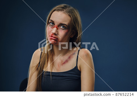 Grieved blonde girl in black t-shirt. Bleeding face covered with bruises, looking at the camera, sitting against blue background. Close-up Grieved blonde girl in black t-shirt. Bleeding face covered with bruises, looking at the camera, sitting against blue background. Close-up 87652214