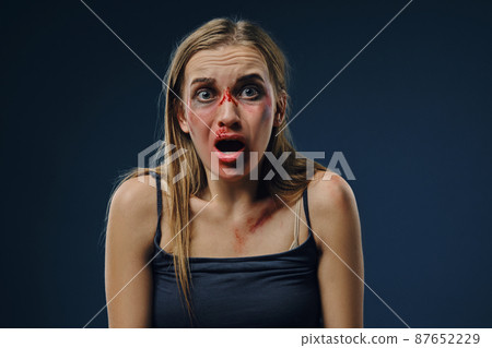 Panicked blonde lady in black t-shirt. Bleeding face covered with bruises, looking scared, sitting against blue background. Close-up 87652229