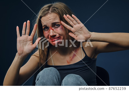 Scared girl in black t-shirt and jeans. Bleeding face covered with bruises, trying protect herself and crying, sitting on blue background. Close-up 87652239