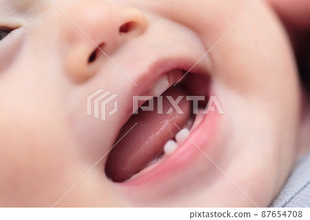 Milk teeth on a 0 year old baby Milk teeth on a 0 year old baby 87654708