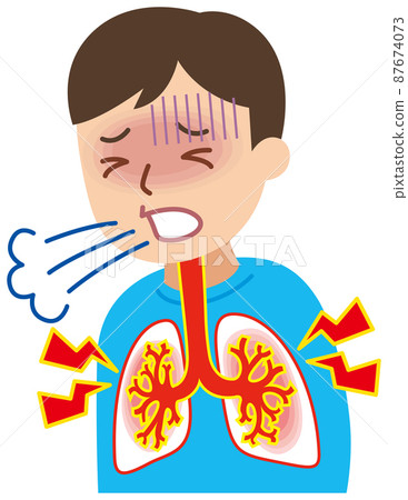 肺炎、支氣管炎的人 87674073