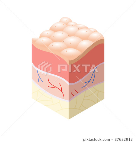 Skincare medical concept. Problems in cross-section of human skin horizontal layers structure. Anatomy illustrative model 87682912