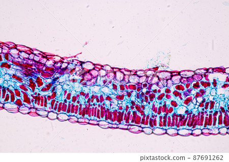 Host cells with spores (mold) are inside wood under the microscope for education. 87691262