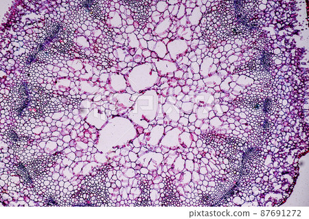 Host cells with spores (mold) are inside wood under the microscope for education. Host cells with spores (mold) are inside wood under the microscope for education. 87691272