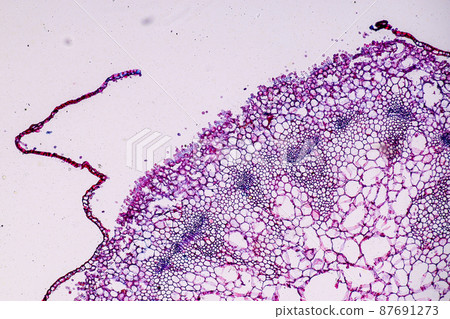 Host cells with spores (mold) are inside wood under the microscope for education. Host cells with spores (mold) are inside wood under the microscope for education. 87691273