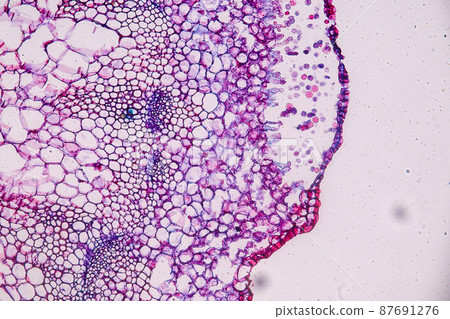 Host cells with spores (mold) are inside wood under the microscope for education. Host cells with spores (mold) are inside wood under the microscope for education. 87691276