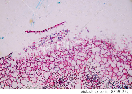 Host cells with spores (mold) are inside wood under the microscope for education. Host cells with spores (mold) are inside wood under the microscope for education. 87691282