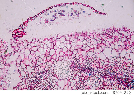 Host cells with spores (mold) are inside wood under the microscope for education. 87691290